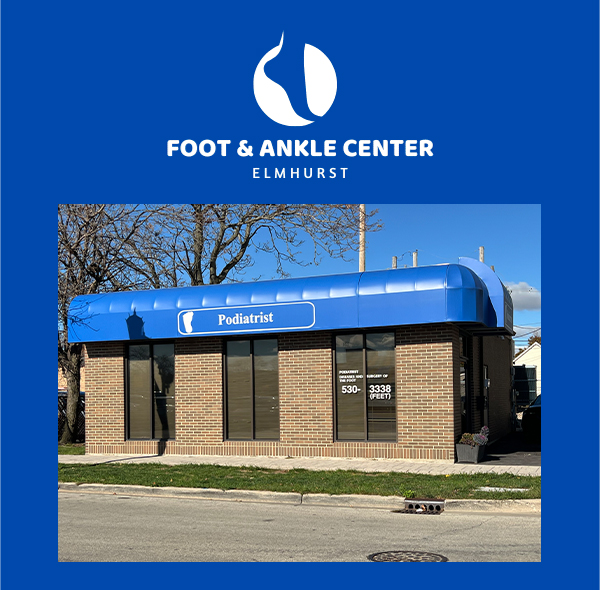 Plantar Fasciitis: Causes, Symptoms, and Treatments | Elmhurst Foot & Ankle Center